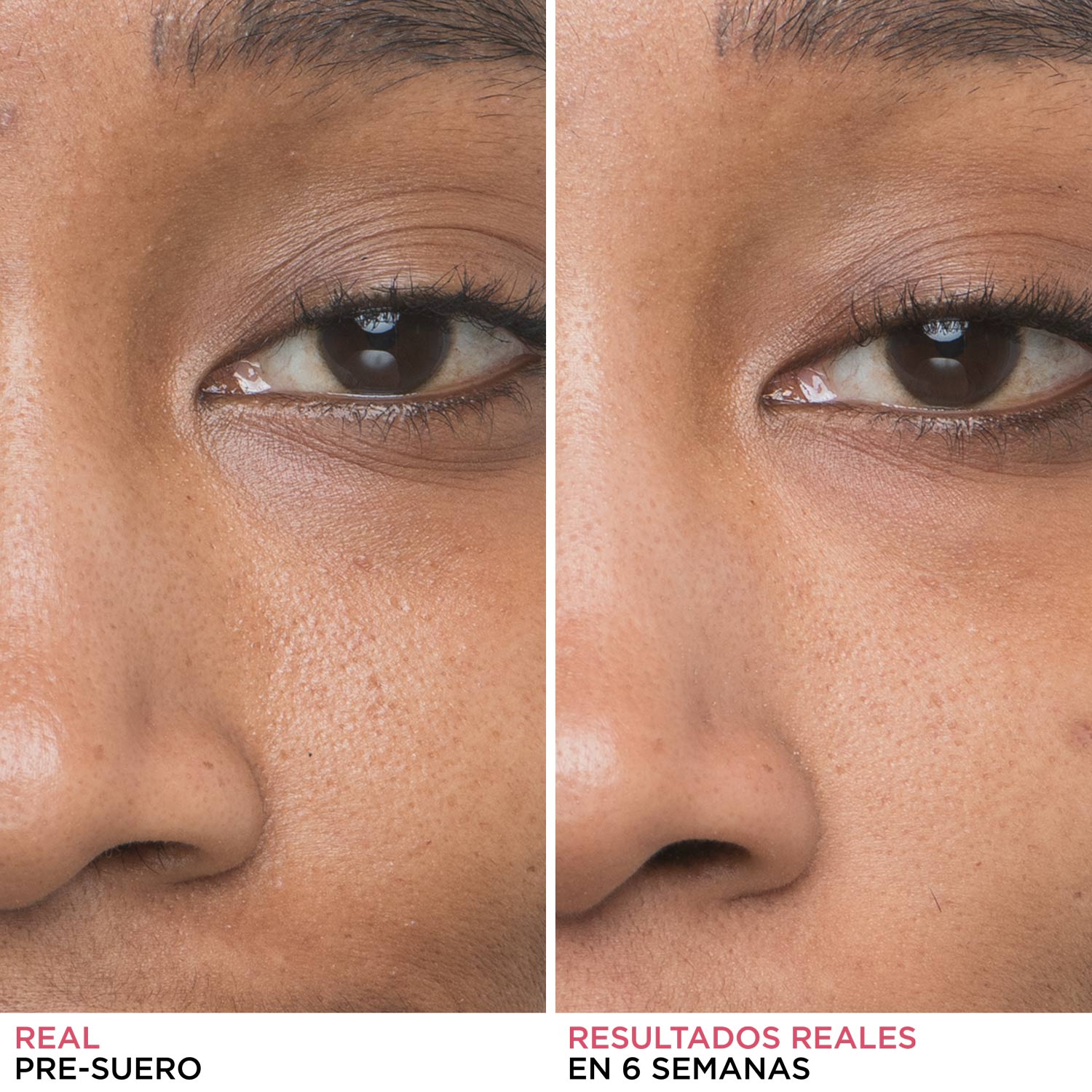 BYE BYE PORES (SUERO DE ÁCIDO GLICÓLICO)